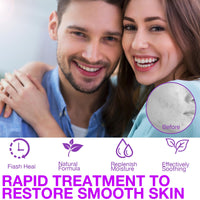 XdealCozyxc 2 PCS The Ordinary Azelaic Acid Serum, Azelaic Acid Cream Brightening Face Skin Care Pigmentation Treatment for All Skin Types