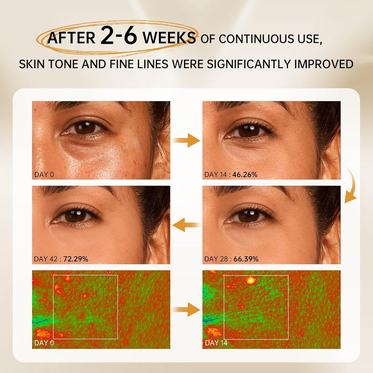 VGO Retinol Serum, Unique Double Active Ingredients of Retinol & Niacinamide, Outstanding Synthetic Effect to Reduce Wrinkle and Dark Circle 29ml