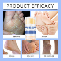 DMQ Urea Foot Cream 60 Percent - Cracked Heel Repair Cream - 60% Urea Cream for Cracked Heels and Dry Skin - Feet Hard Skin Remover - Moisturizing Hands and Foot Skin Care