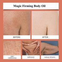 SinceReal Magic Firming Body Oil, Magic Luxury Body Oil, Skin Tightening Oils for Women Smooth, Radiant Skin, Reduce Finelines, Moisturizing