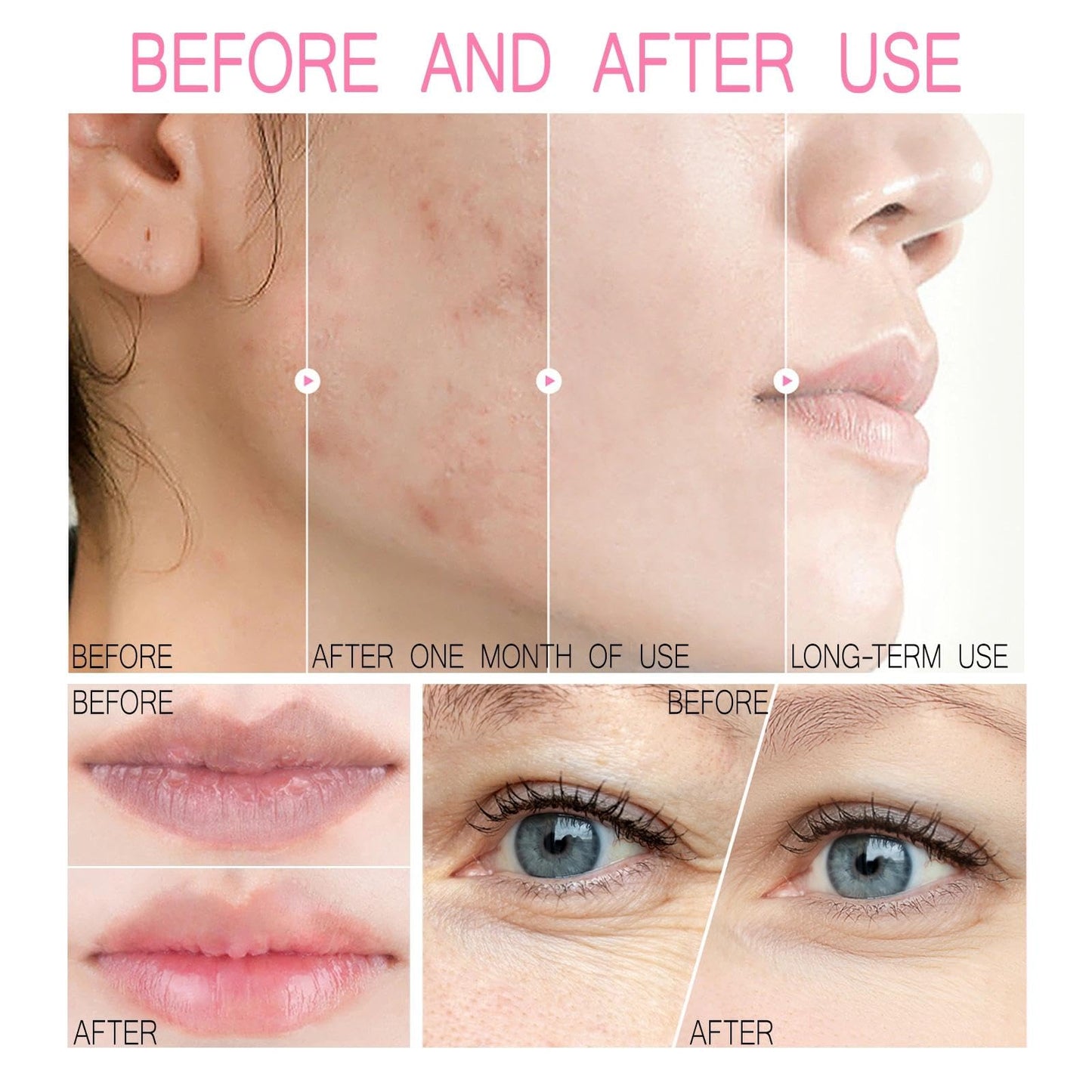 Maggikey Sakura Skincare Set For Women. Inspired By Japan, It Has Serum, Cleanser, Eye Cream, Cream, Plus Face And Lip Masks For Skin Tending