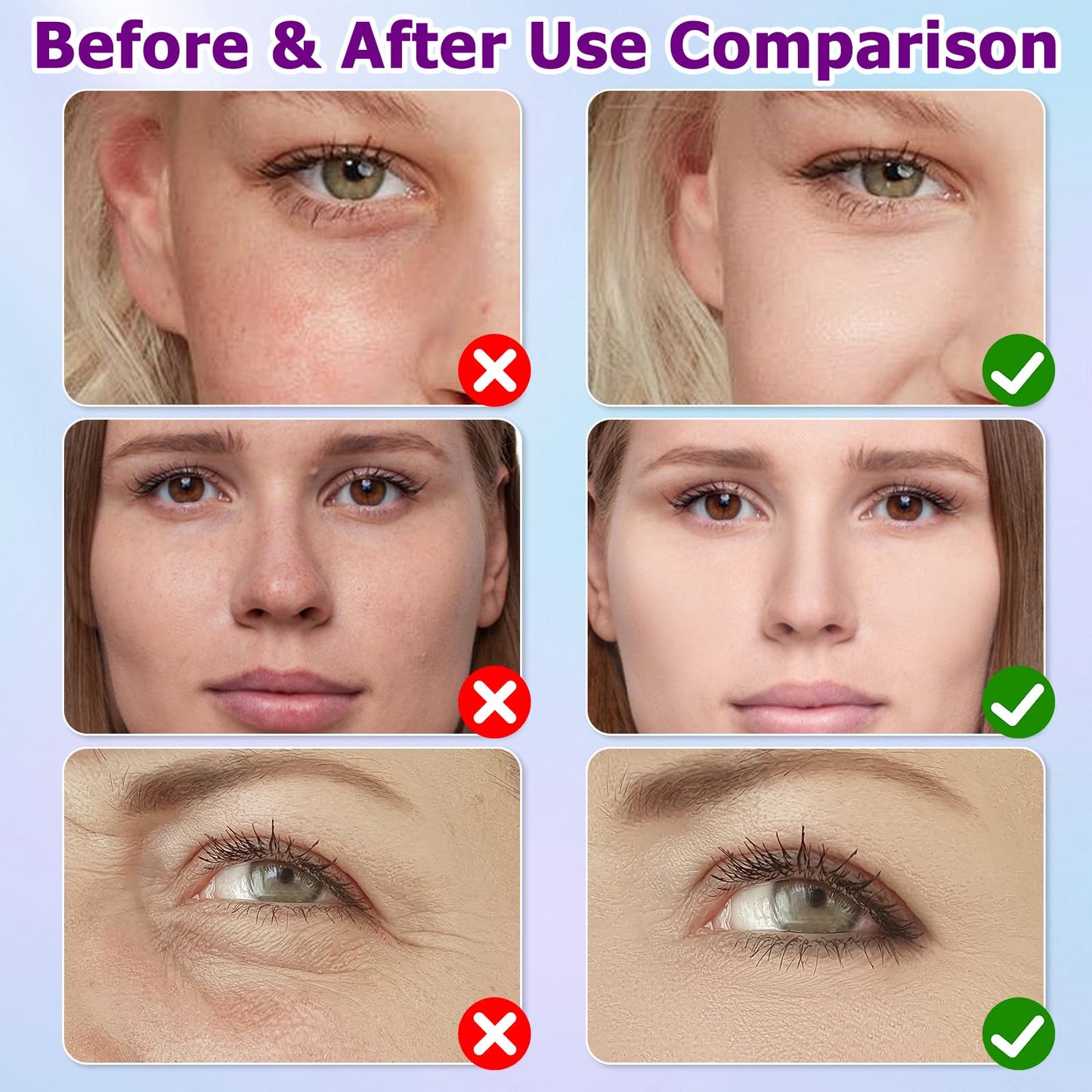 Muiefe 2Pcs Sunscreen SPF 100+, Sun Cream SPF 100 PA+++, Sunscreen Lotion For Body & Face, High Protection Against UVA & UVB, Water & Sweat Resistant, Non-Greasy, Long-Lasting Moisturizing Sun Care