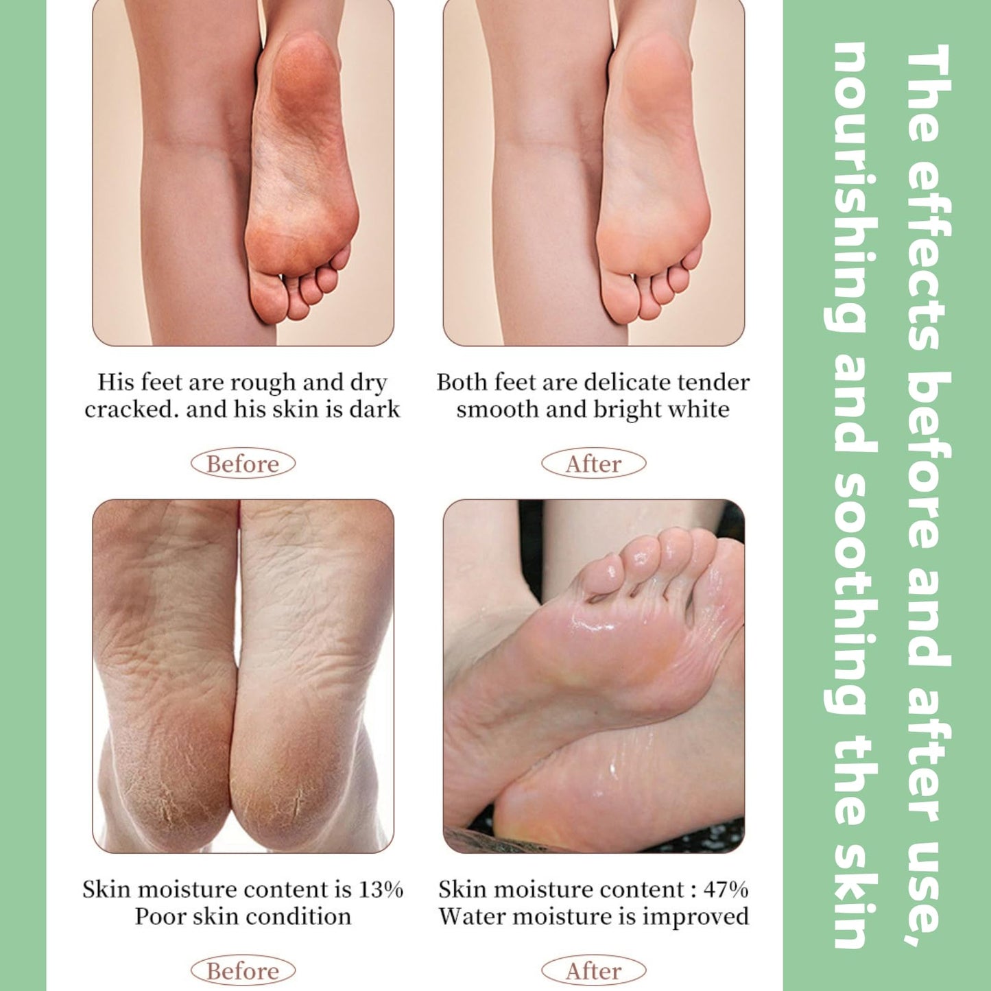 5 Pairs Mint & Tea Tree Foot Peel Mask – Exfoliating Foot Mask for Dry, Cracked Heels – Foot Care Socks for Women & Men - Softens Hard Skin & Hydrates for a Pampering Effect