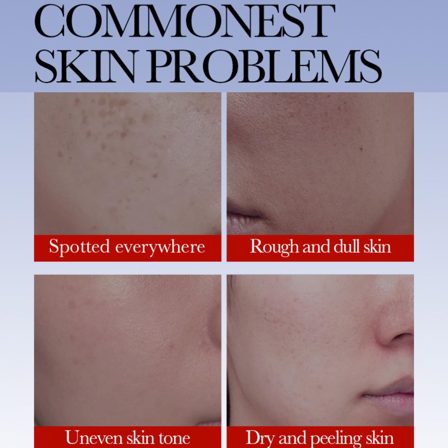 Cureluxe Dark Spot Remover For Face Cream For Women - Freckle Removal Cream – Face Moisturizer For Dark Spots – Hydrating & Skin Tone Enhancing Cream – Fade Freckles & Improve Dull Skin