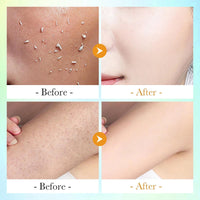 AuraBeen Orange Peeling Essence - Revitalizing Facial Exfoliator for Deep Cleansing, Gentle Exfoliation, and Radiant Skin Essence, Ideal for Both Face and Body