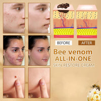 OXGPAL Bee Venom All-in-One Cream, Bee Venom Skin Treatment Cream, Bee Venom Comprehensive cream,Bee Venom Skin Repair Cream, Powerful All-Body Skin Cream for Face and Body, for All Skin Types (60G)