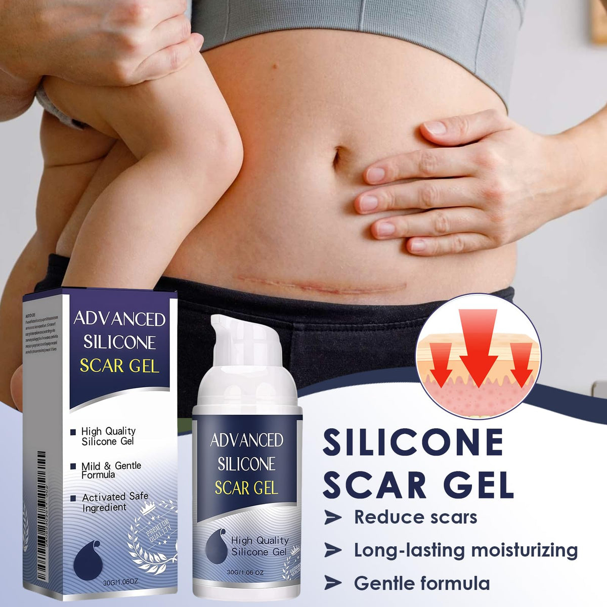 Uheltosly 30g Scar Gel, Scar Cream, Mild and Moisturizing Scar Removal Cream, Stretch Mark Cream, Recovery for Old and New Scars