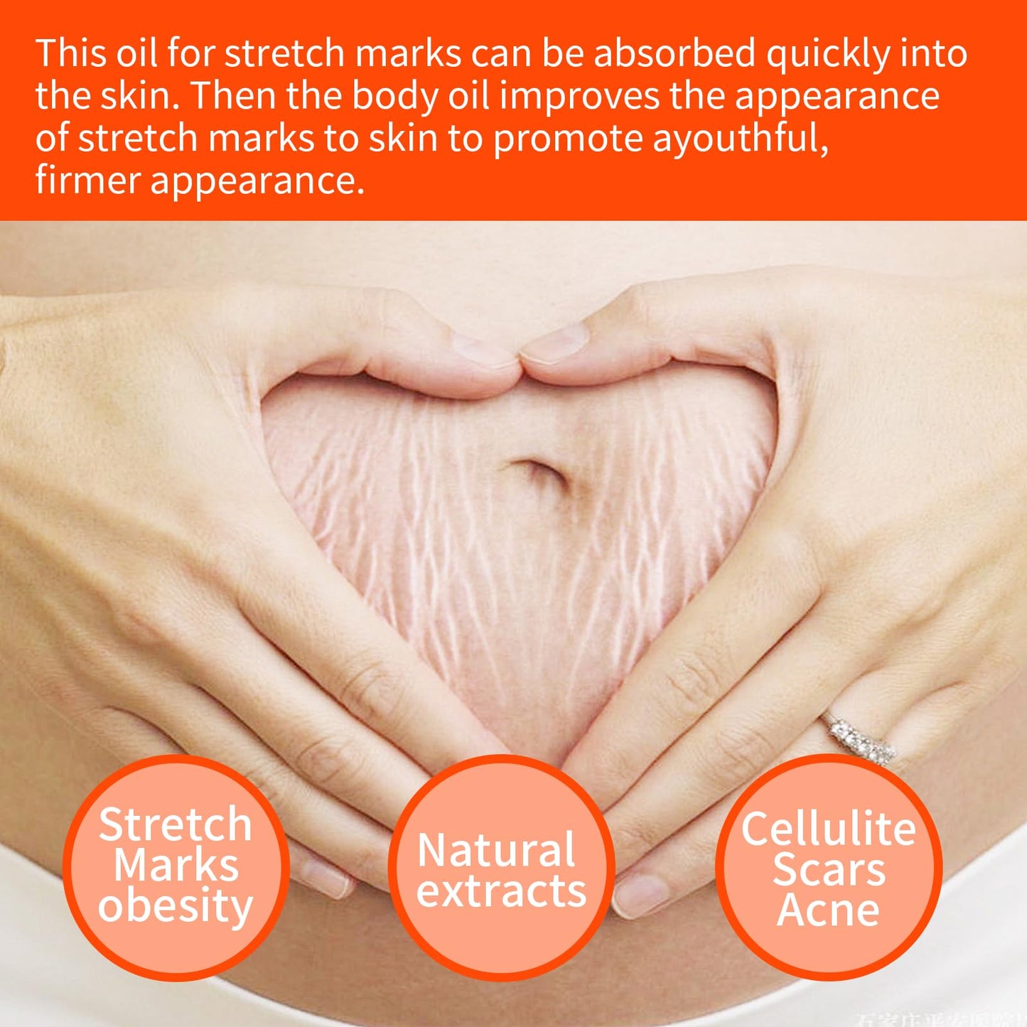 PlusBee Bio Oil Scar Treatment, Collagen Boosting Oil for Scars, Stretch Marks & Uneven Skin Tone, Skincare Serum for Pregnancy, Acne & Surgery Scars, 125ml