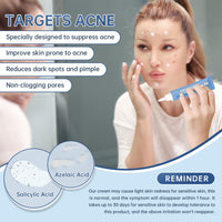 BECHOICEN Azelaic Acid face serum cream for Redness Relief,Dark Spots,Azelaic Acid Acne Cream with Niacinamide & Vitamin C,Acid 14% Facial Serum Balance Excess Sebum & Soothe Irritation,30ml