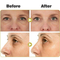 AmiCera Dark Circle Eye Cream, Advanced Snail Peptide Eye Cream Stick for Dark Circles and Puffy Eyes, Under Eye Brightener, Eye Bags Remover, for Men & Women, Anti-wrinkle, Hydrating