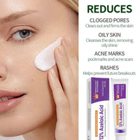 (2PCS)Azelaic Acid Face Cream, Azelaic Acid 12% Facial Serum Cream, Niacinamide & Vitamin C for Redness Face, Dark Spot, Rosacea,Acne,Face Skin Care Beauty Products,Skincare for All Skin Types 20G (2)