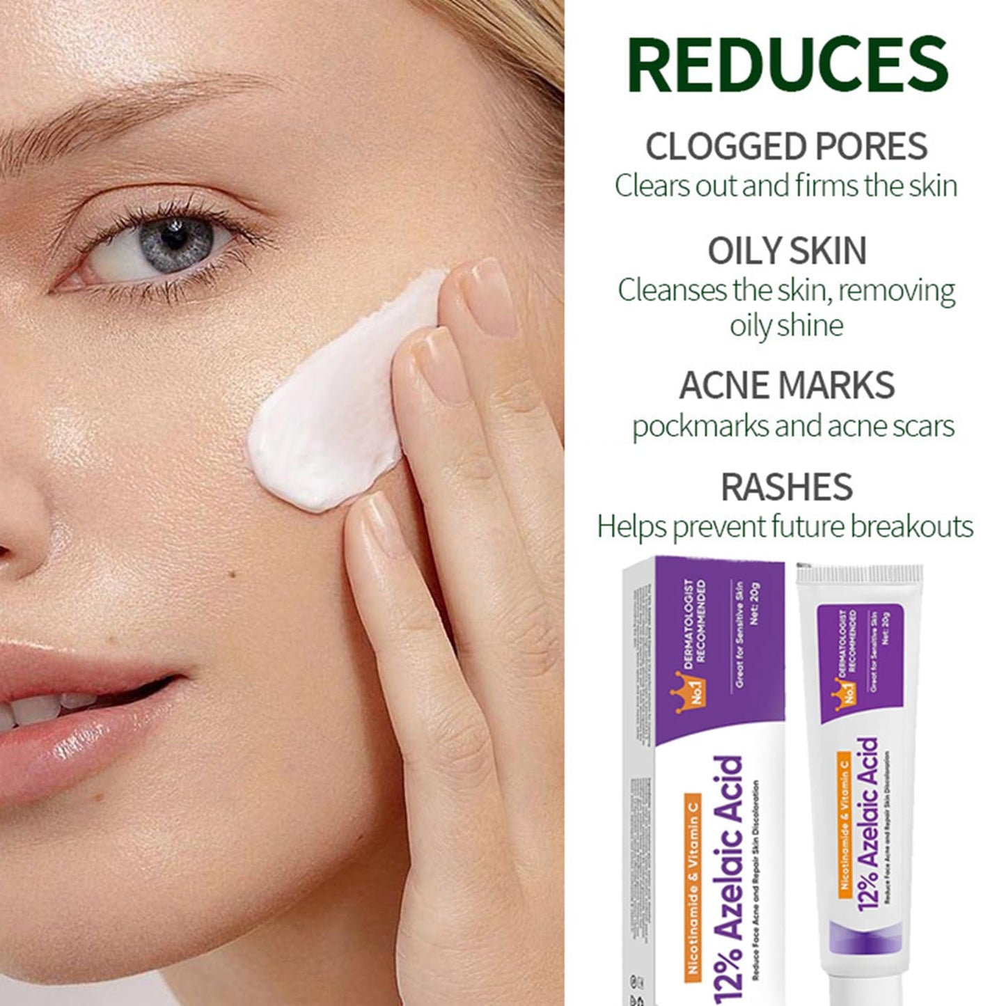 Night Cream Face Moisturiser, Azelaic Acid 12% Facial Serum Cream,Dark Spot Serum Cream for Face,Skincare with Niacinamide & Vitamin C,Beauty Products for Rosacea,Acne,Balance Excess Sebum