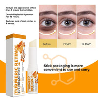 agctrler 2 Pieces Turmeric Eye Cream Stick, Turmeric Retinol Eye Balm Pen, Retinol Eye Cream, for Dark Circles and Wrinkles, Reduces Puffiness, Fine Lines and Eye Bags, for All Skin Types
