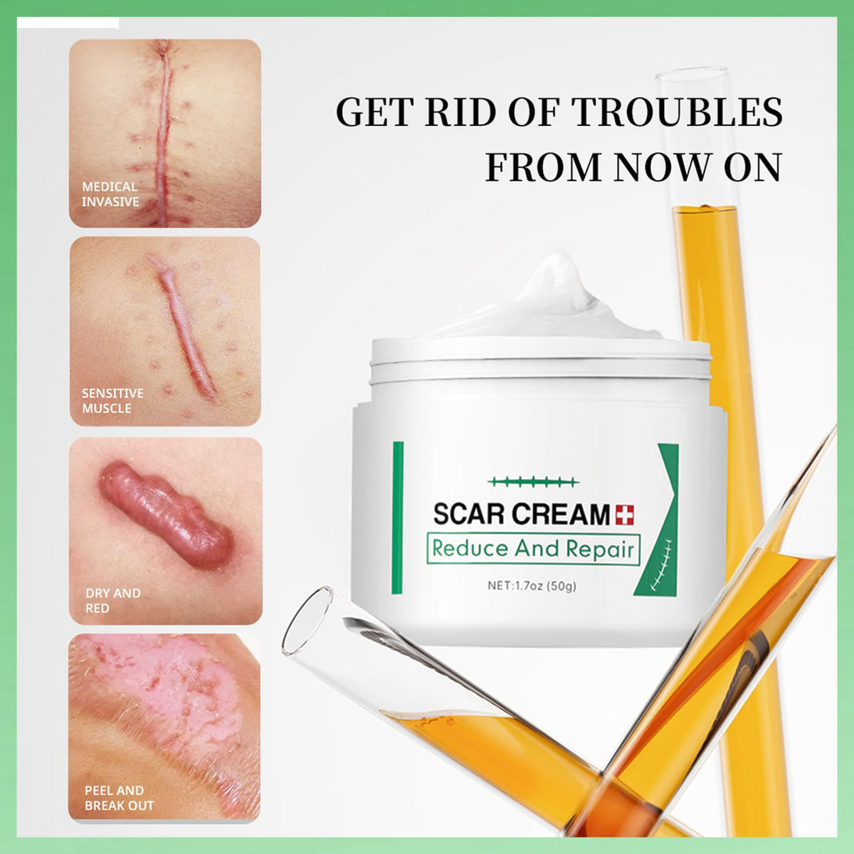 MINSHZEE Scar Removal Cream for Face & Body - Treatment for New Scars, Stretch Marks, Acne Spots & C-Sections Treatment Cream, 50g, Natural Formula for Face and Body, Reduces Old and New Scars