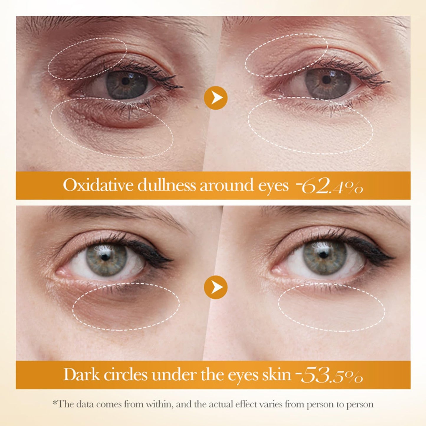 RUICHING Lumibalm Upcircle Eye Cream, Turmeric Eye Cream for Dark Circles and Puffy Eyes, Anti Aging Tightening Reduce Fine Line Under Eye Brightener, Smooth Firm Eye Moisturiser, All Skin Types