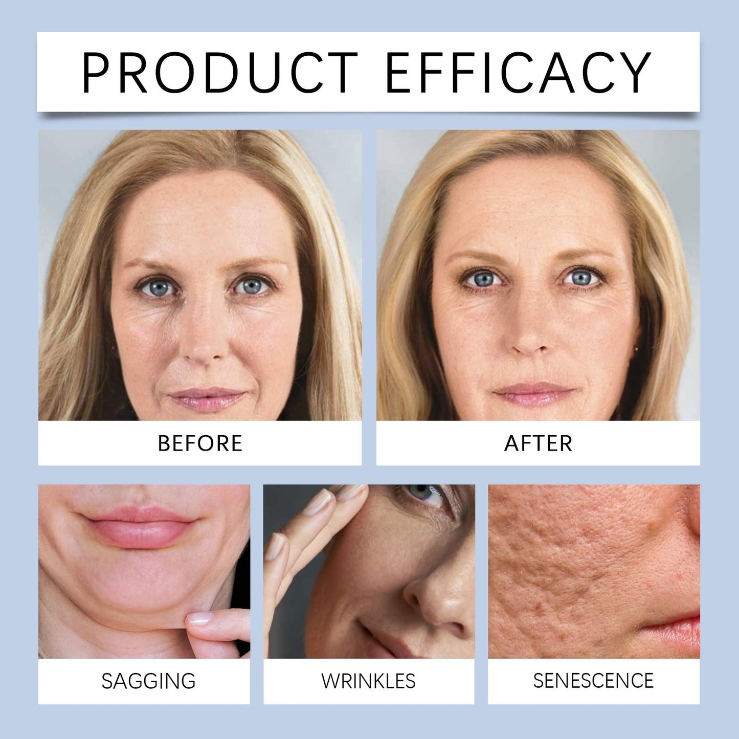 SHEBEEDO Hydrogel Mask Overnight, Intense Hydration,Bio Hydrating Face Mask Overnight,With Hyaluronic Acid, Glacier Water & Ceramide, Reduce Fine Lines & Wrinkles, Pore Minimizing