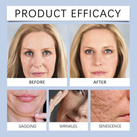 SHEBEEDO Hydrogel Mask Overnight, Intense Hydration,Bio Hydrating Face Mask Overnight,With Hyaluronic Acid, Glacier Water & Ceramide, Reduce Fine Lines & Wrinkles, Pore Minimizing