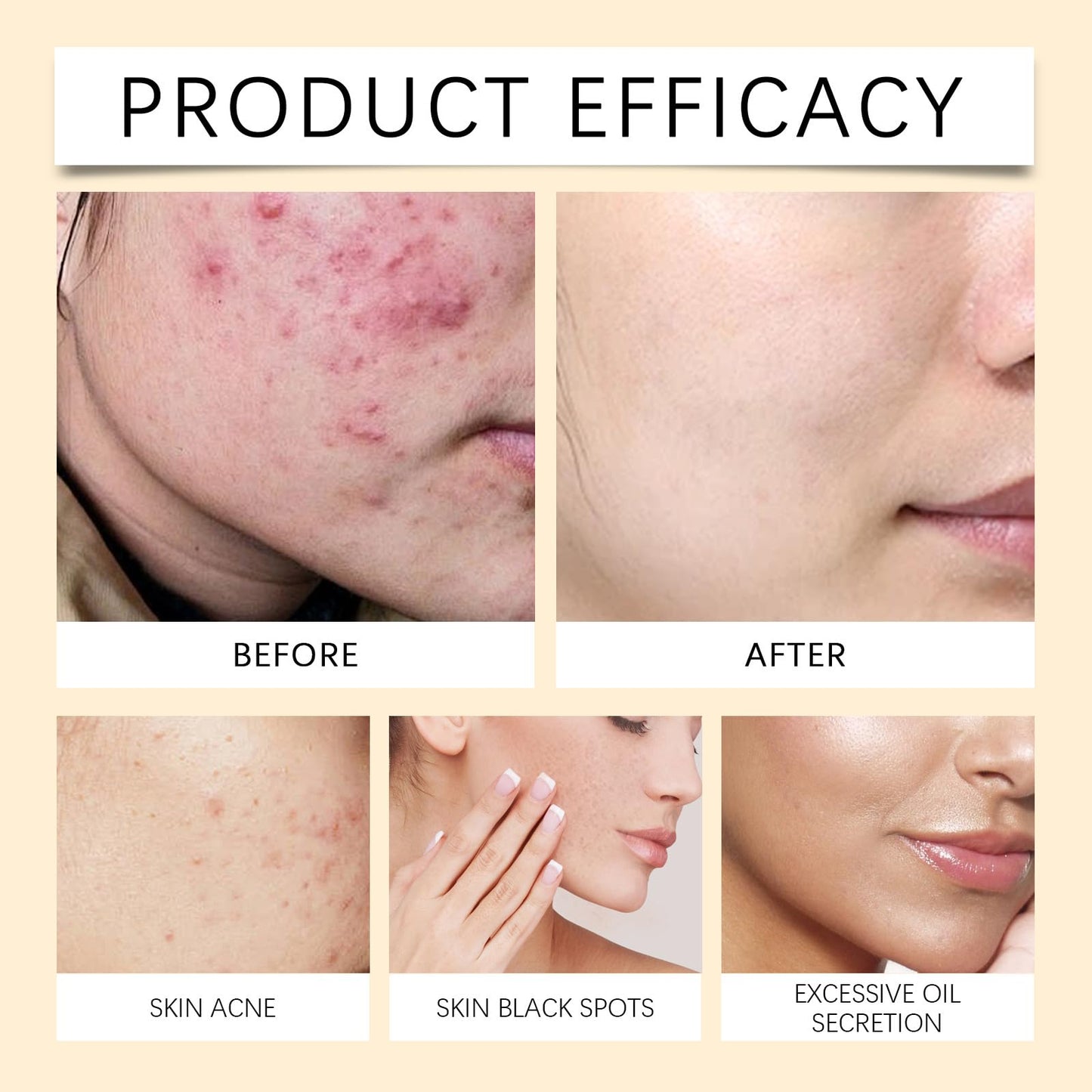 Lomeya Korean Rice and Honey Clay Mask for Glass Skin, Hydration and Deep Cleansing, Perfects Skin Tone and Brightens, Ideal Face Mask for Skincare