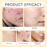 Lomeya Korean Rice and Honey Clay Mask for Glass Skin, Hydration and Deep Cleansing, Perfects Skin Tone and Brightens, Ideal Face Mask for Skincare