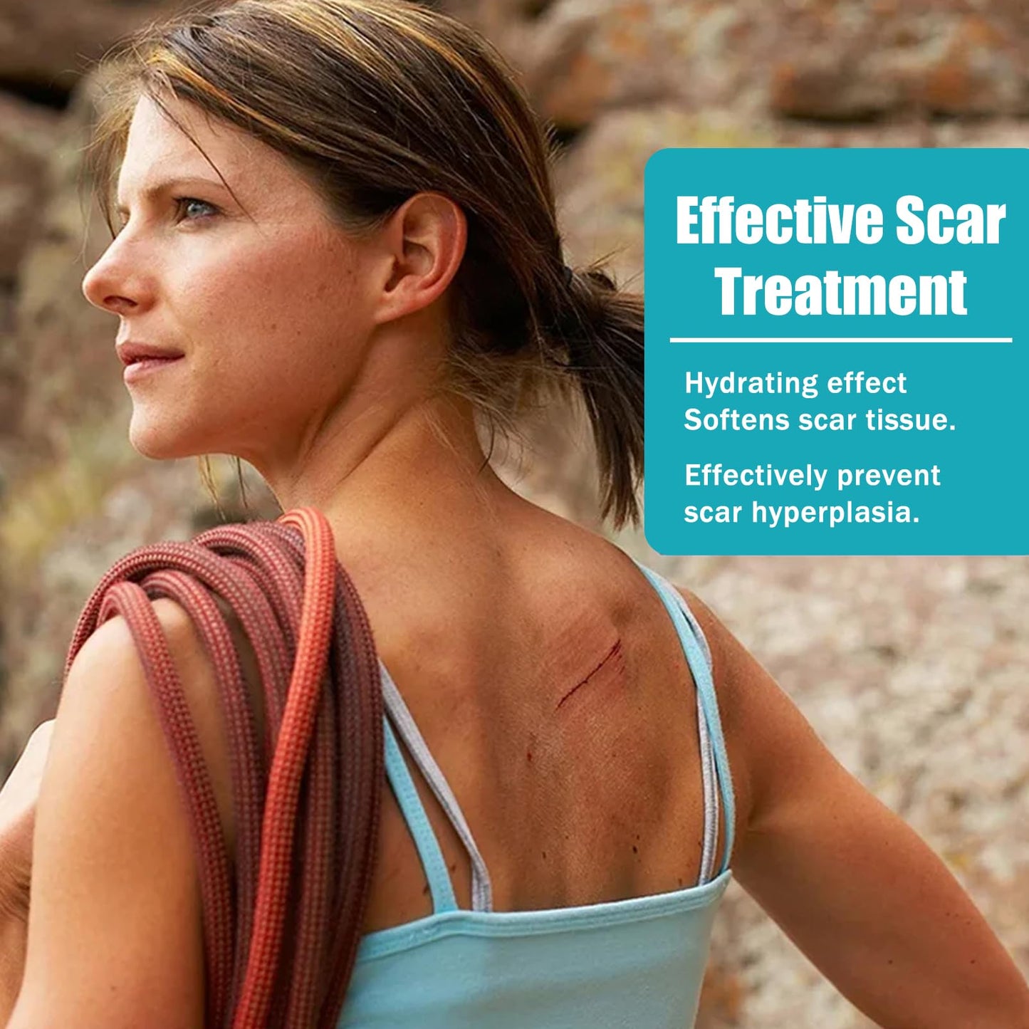 Scar Cream, Scar Removal Cream, Stretch Mark Removal Cream, Scar Erase, Skin Repair Cream for Face & Body Scar, for C-Section, Burns, Stretch Marks, Acne, Surgery, Effective for Both Old and New Scars