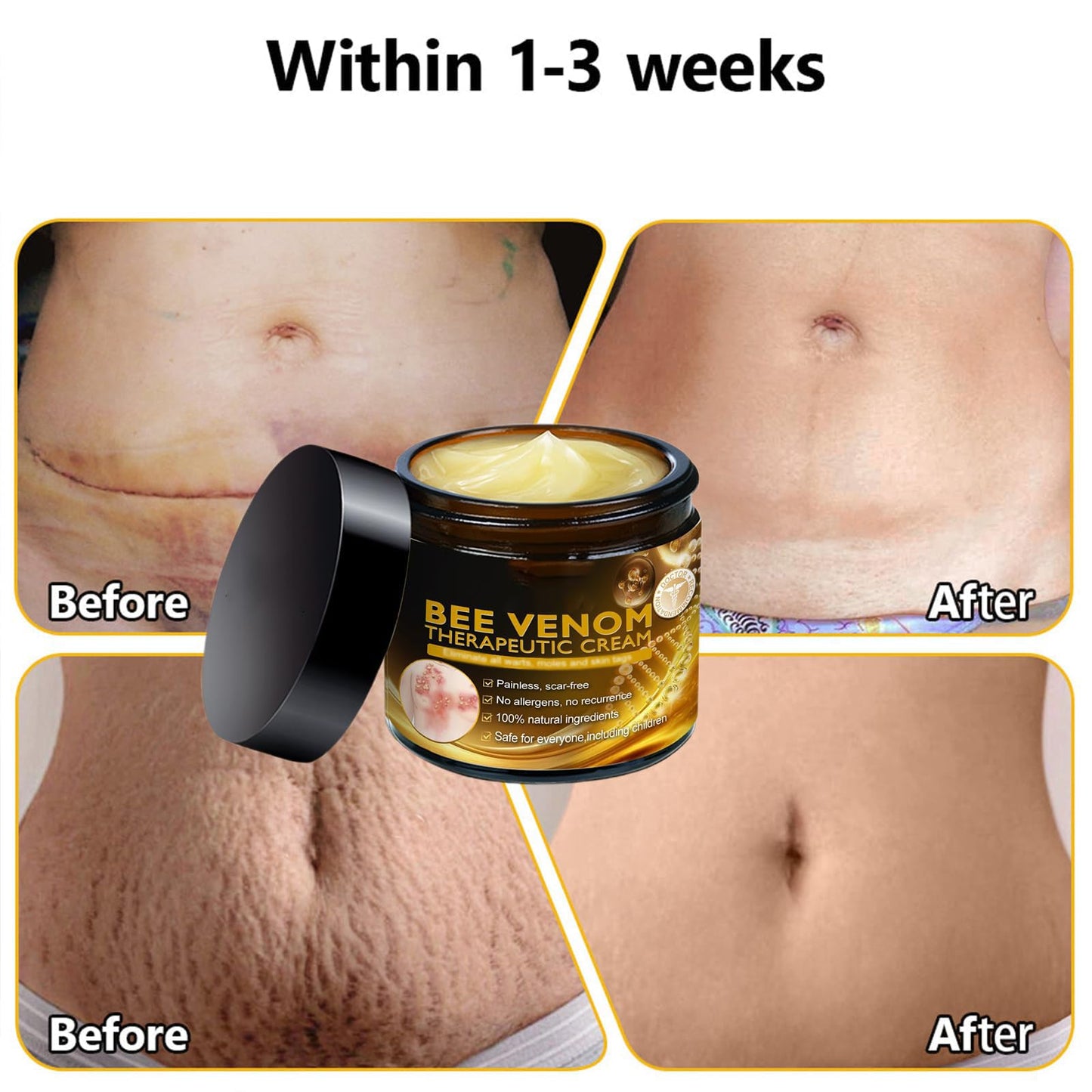 DEJIN Bee Venom Skin Treatment Cream: Professional Bee Venom Repair & Moisturizing Cream for All Skin Types - Hydrating Formula