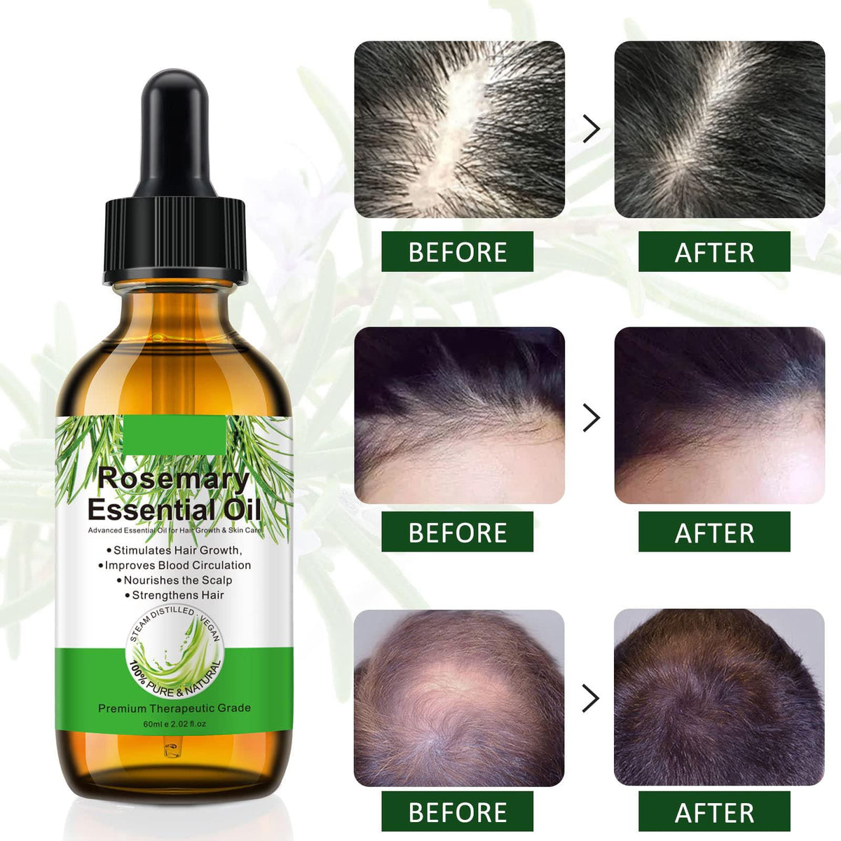 find back Rosemary Oil for Hair Growth,2 Pack Rosemary Essential Oil for Hair Loss Regrowth, Strengthens Hair, Nourishes Scalp, Light Weight, Non Greasy, Improves Scalp Circulation For Men And Women 2*2.02 Oz