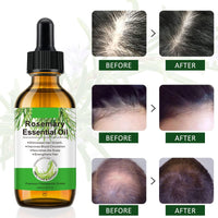 find back Rosemary Oil for Hair Growth,2 Pack Rosemary Essential Oil for Hair Loss Regrowth, Strengthens Hair, Nourishes Scalp, Light Weight, Non Greasy, Improves Scalp Circulation For Men And Women 2*2.02 Oz
