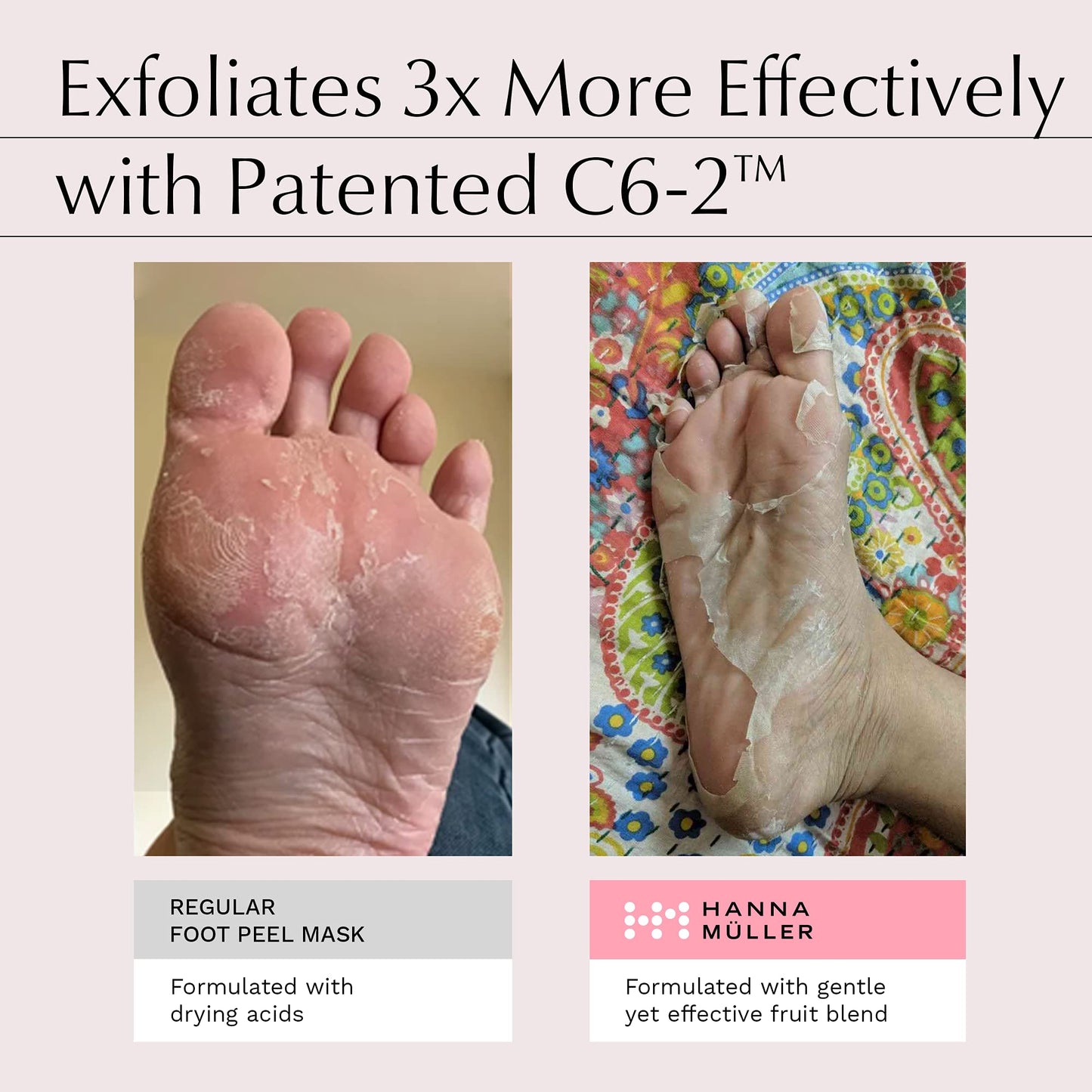 Hanna Müller 3 Pairs Foot Peel Mask - Foot Exfoliator and Foot Peel Mask for Hard Skin and Cracked Heel, Foot Masks with AHA Blend, Salicylic Acid, Botanical Extracts, Vitamin C and A, Feet Peeling Mask