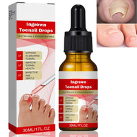 Ingrown Toenail Treatment Drop,Nail Growth Ingrowing Toenail Treatment,Cuticle Care Oils for Ingrown Toenails,Nail Growth Treatment,Ingrowing Toe Nail Treatment,Toe Nail Fungus Treatment Cuticle Oil
