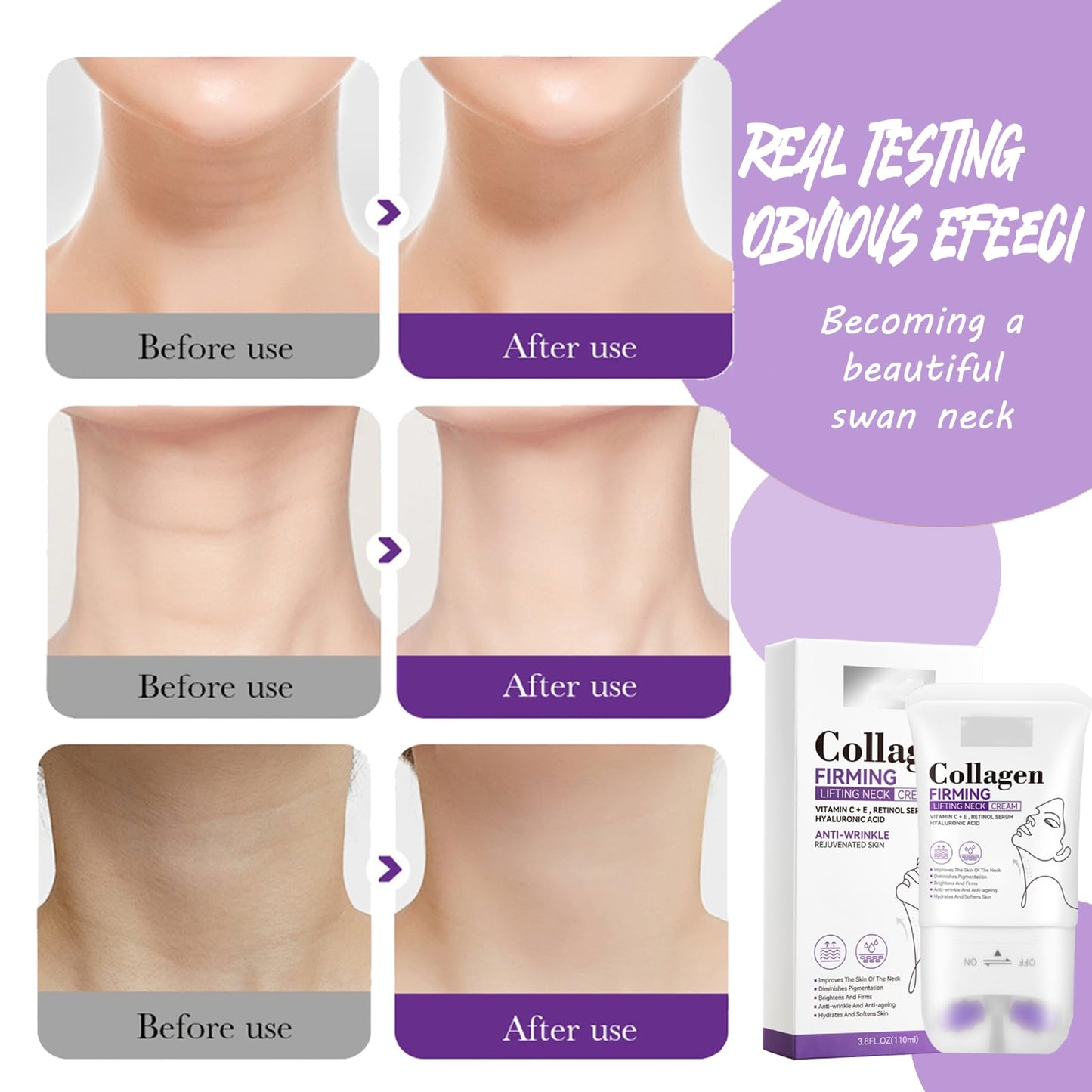 Neck Creams for Firming Roller - Collagen Neck Cream - Retion Neck Firming Cream - Anti Aging and Anti Wrinkle Neck Cream - Rich in Vitamin C+E and Hyaluronic Acid - Neck Moisturizer