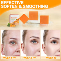 Trendyfave Turmeric Soap (2 Pcs) Natural Turmeric Soap Bar for Acne & Dark Spots, Hyperpigmentation Smoothing Skin with Turmeric Root Extract, Cleanser, Deep Moisturizing & Gentle for All Skin Types
