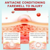 Acne Treatment Cream – Fast Acting Spot Treatment for Face - Blemish Control Cleanser Reduces Pimples, Blackheads & Blemishes - Gentle Skin Care for Oily & Acne-Prone Skin, 40g (2 Value Packs)