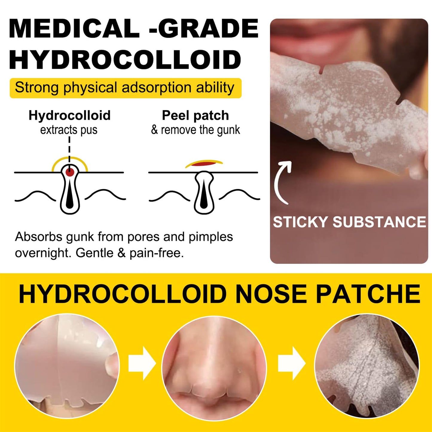 SHEBEEDO 12Pcs Hydrocolloid Nose Strips,Blackhead Remover Strips,Nose Pore Strips for Unclog and Shrink Pores,Absorbs Oil,Removal Acne,Pimple,Zits,Spot,Targets Pores & Pimples