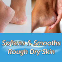 Masterplast Heel Balm | Moisturising Repair Cream for Dry, Cracked and Chapped feet | Hydrating Foot Cream - Fragrance Free (70g Tube)