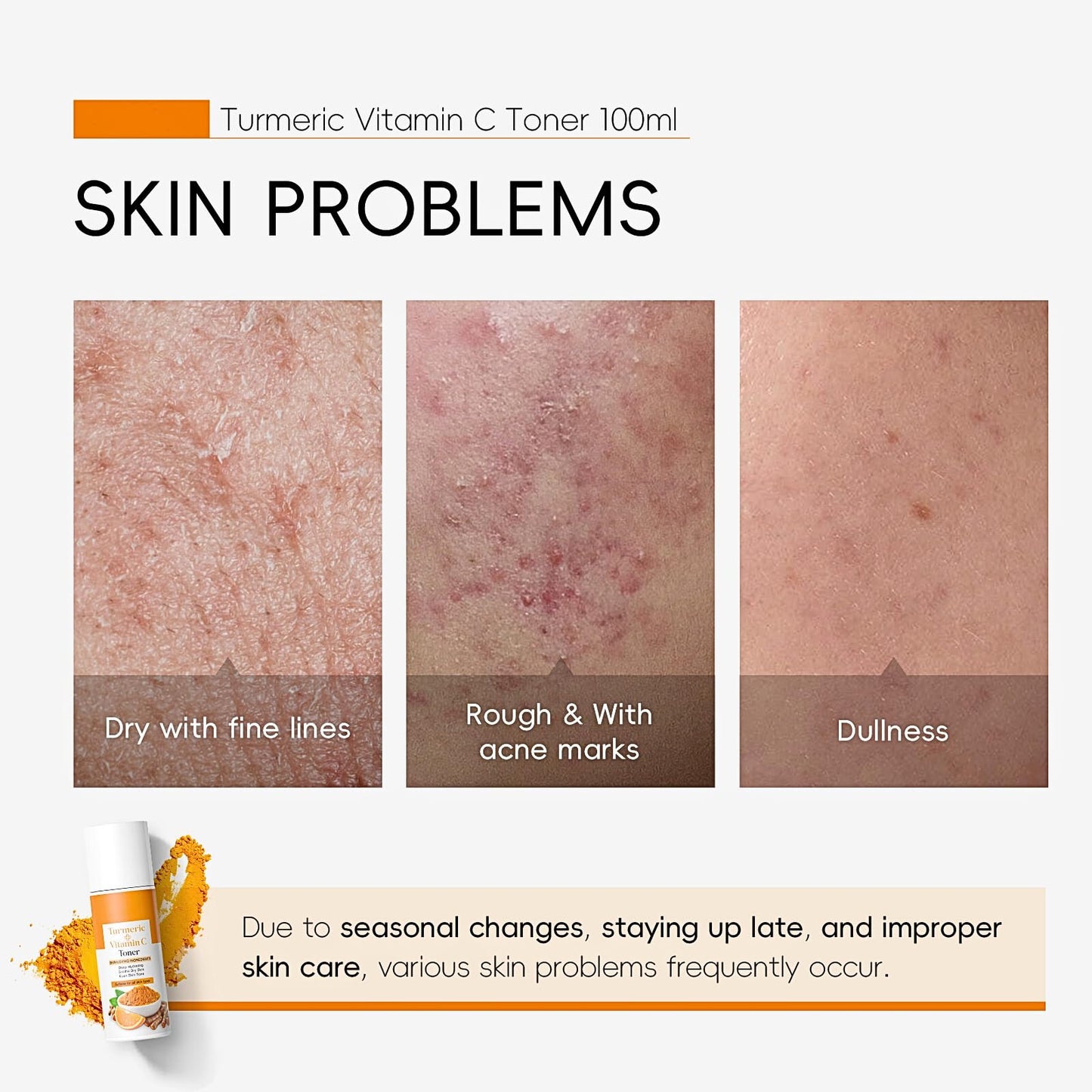 TBeautfave Vitamin C + Turmeric Face Toner | Turmeric Toner for Face | Brightening Facial Toner | Hydrating Toner | Pore Minimizer | Reduce Dark Spots & Acne | Alcohol Free | 100ml