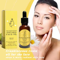 Generic Frankincense Resin Oil for Face - Organic Botanical Extract for Skin, Deeply Hydrates and Softens, Lightweight Feel, Non-Greasy Formula, Supports Radiant Complexion, Facial Nourishing Oil, 30ML