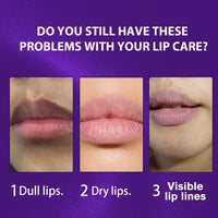 Xunzhi Lip Lightening for Dark Lips,Moisturizing L/ip Care Cream,L/ip Balm Stick,Deep Moisturization Li/p Balm,Li/p B/alm Hydrating and Brightening Dark L-ips,Li-p Repair B/alm for Dry Cracked Li-ps,5g