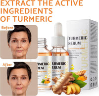 Leogony 2PCS Lightening Turmeric Serum Dark Spot Removal Corrector for Face Skin Glow, 30 ml, Anti Aging, Hydrating, Reduce Wrinkles
