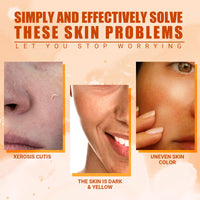 Bploar Vitamin C Brightening Serum