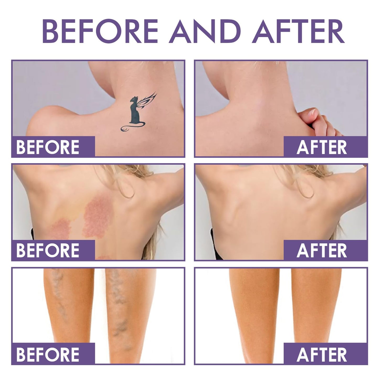 NLFOX All Over Complexion Perfector - Body Coverage Perfector Waterproof - Tattoo Cover Up Makeup Body Foundation Full Coverage - Body Coverage Perfector All in One Moisturiser Concealer,74ml