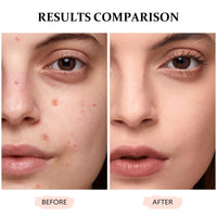 COODAM Concealer Full Coverage for Mature Skin - Eye Concealer Concealer Full Coverage Lasting Perfection Concealer for All Skin (#Honey, 12ml)