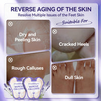 LANBENA Foot Peel Mask - 1 Pair Moisturizing and Exfoliating Foot Peeling Mask for Dry, Cracked Feet | Callus Remover | Skin - Friendly and Effective for Baby Soft Feet, Men and Women (Lavender)