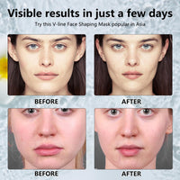 5Pcs V Line Face Lifting Chin Mask, Bloskin Double Chin Mask, Face Lift Tape for Tighten Jawline, Lift Face, Nourish Skin