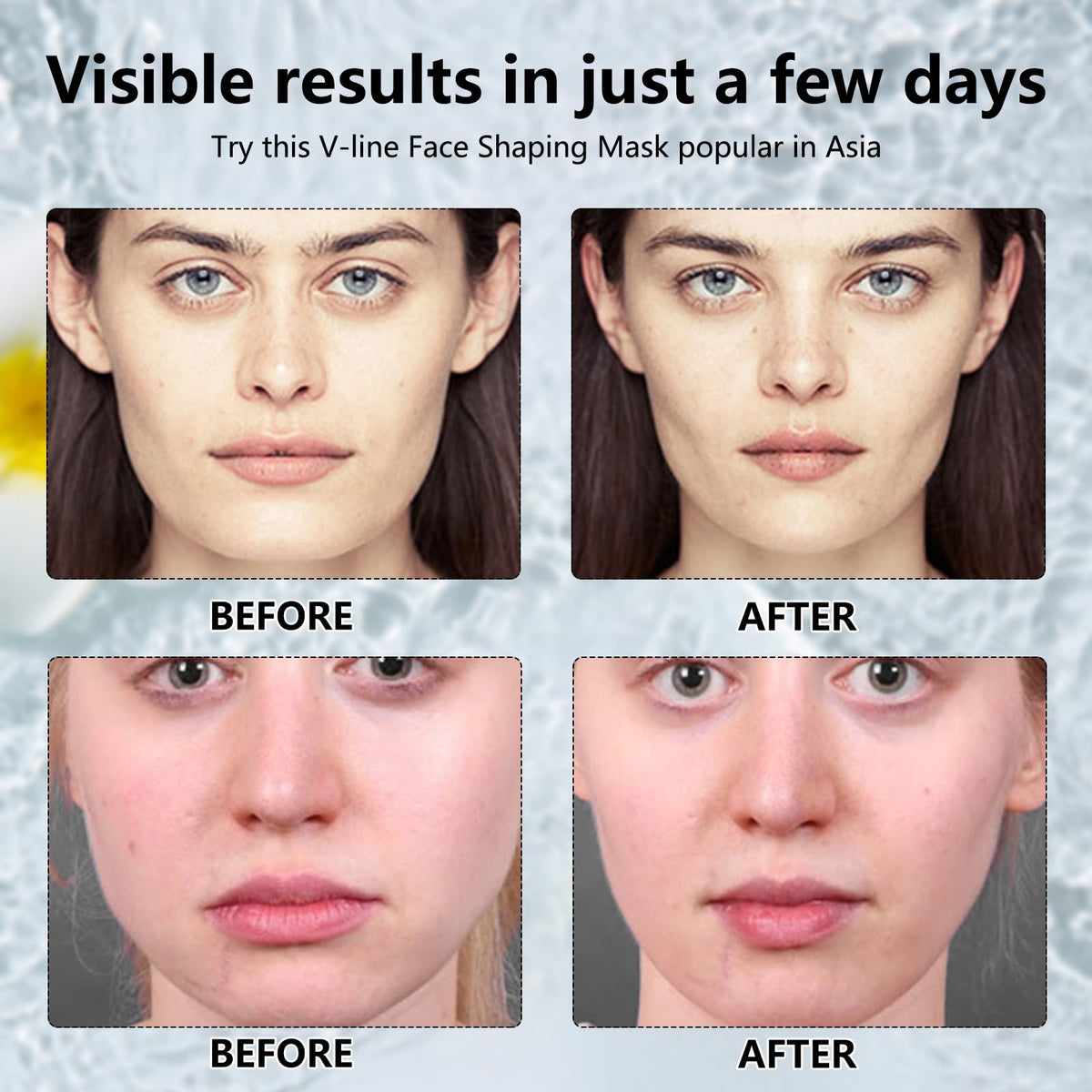 Nadiaen 5Pcs V Line Face Lifting Chin Mask, Bloskin Double Chin Mask, Face Lift Tape for Tighten Jawline, Lift Face, Nourish Skin