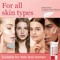 Muiefe 2Pcs Freckle Removal Cream, Dark Spot Remover for Face and Body, Dark Spot Corrector Cream with Vitamin C, E & Niacinamide, Fade Spots Blemishes, Reduces Hyperpigmentation, Improves Skin Tone