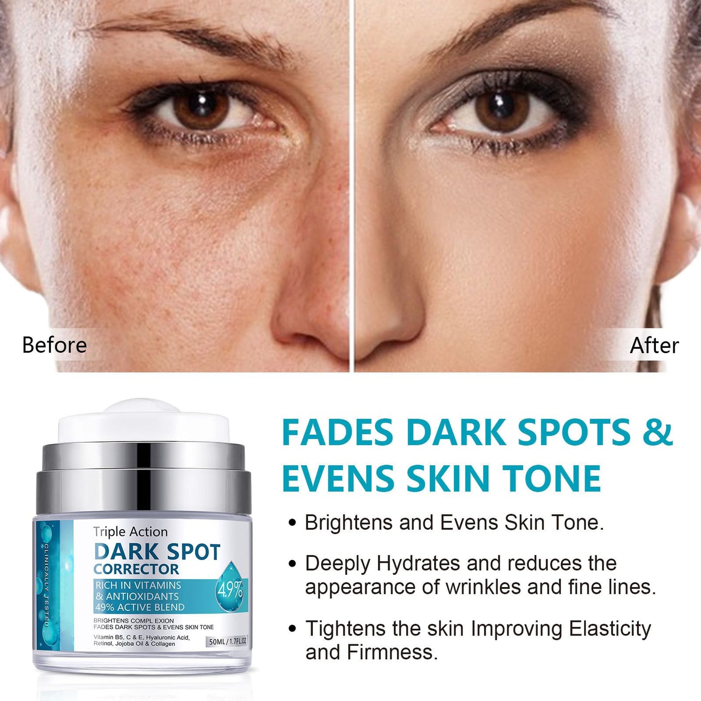 Shefave Dark Spot Remover For Face & Body, Pigmentation Removal Cream, Hyperpigmentation Treatment Melasma Cream - Reduces Dark Spots, Hyperpigmentation & Scars, Hydrates & Evens Skin Tone For Radiant Glow