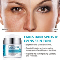 Shefave Dark Spot Remover For Face & Body, Pigmentation Removal Cream, Hyperpigmentation Treatment Melasma Cream - Reduces Dark Spots, Hyperpigmentation & Scars, Hydrates & Evens Skin Tone For Radiant Glow