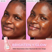 Glow Recipe Watermelon Niacinamide Dew Drops, Travel Size, Korean Niacinamide Serum Drops, Hydrating Face Serum + Primer & Liquid Highlighter, Hyaluronic Acid, Dewy Glow (15ml)