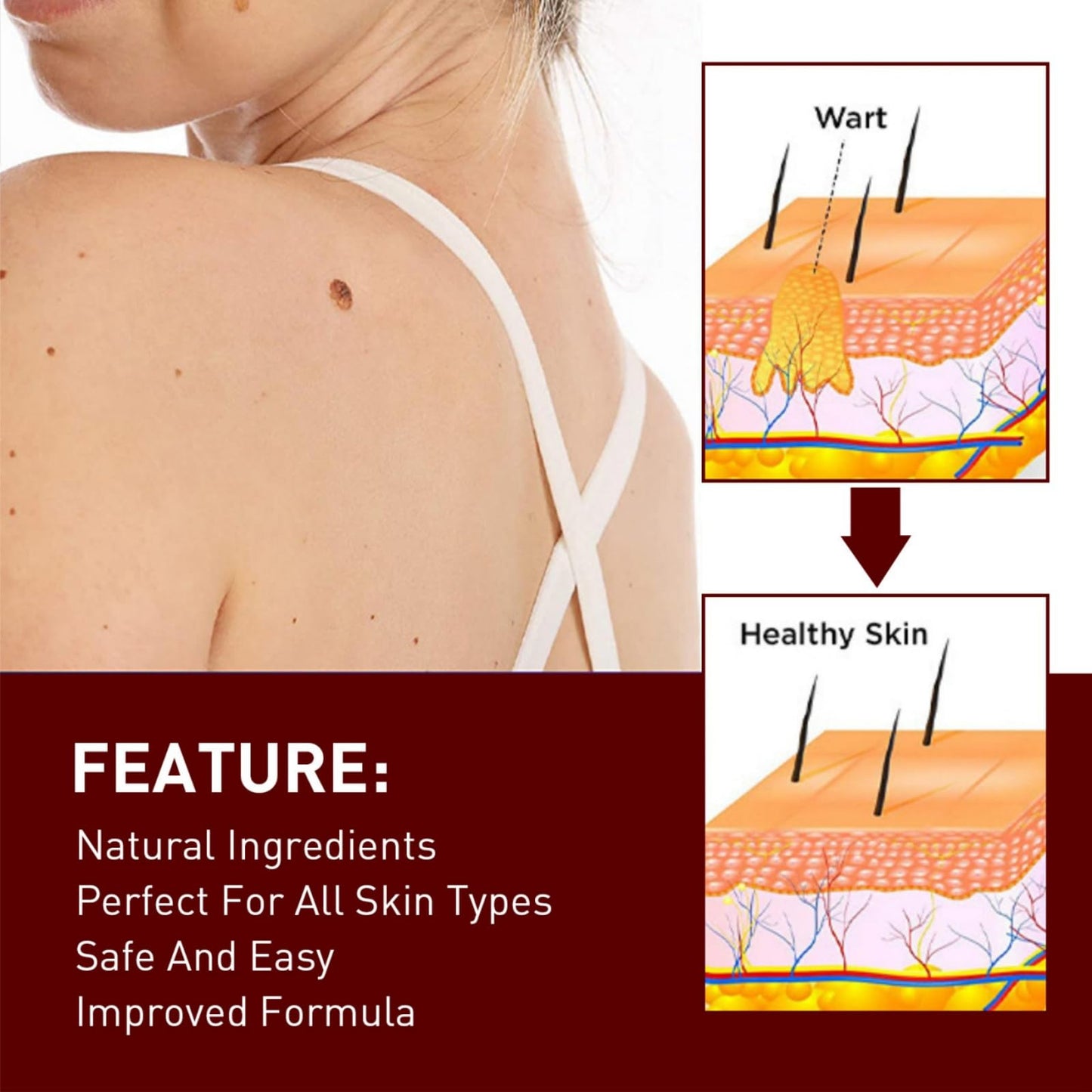 Wart Remover Pen,Mole and Wart Removal Pen,Dark Spots Treatments Mole Wa/rt Remover for Face,Liquid Pe/n Stops Regrowth Skin Care,Easy Removal P/en,Wa/rt Remov/ers for Sk/in Type,Verruca Treatments