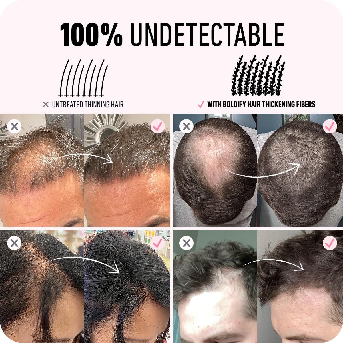 Boldify BOLDIFY Hair Fibres for Thinning Hair (DARK AUBURN) - 28g Bottle - Undetectable & Natural Hair Filler Instantly Conceals Hair Loss - Hair Powder Thickener, Topper for Fine Hair for Women & Men